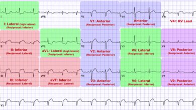 leads for ekg