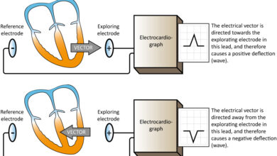 leads on ecg